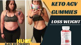 Loss Weight Fast In 2023 Use  KETO ACV GUMMIES product