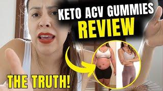 KETOLABS KETO + ACV GUMMIES ((THE TRUTH!))- KETOLABS KETO ACV GUMMIES REVIEW - KETO ACV GUMMIES [xh3fpgzkj]